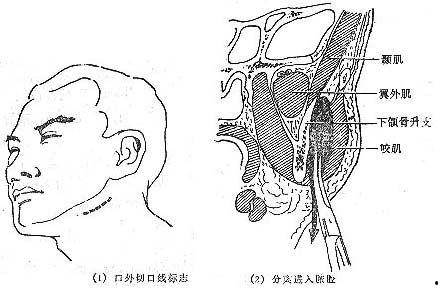 肌之间隙在线观看,揭秘人体肌肉奥秘的在线之旅